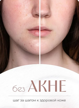 [Ксения Машкина] [dr_mashkina] БезАкне (2023)_0.png